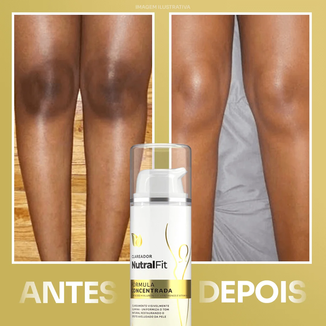 Clareador NutralFit - Imagem de antes e depois - percebesse uma grande diferença na pele