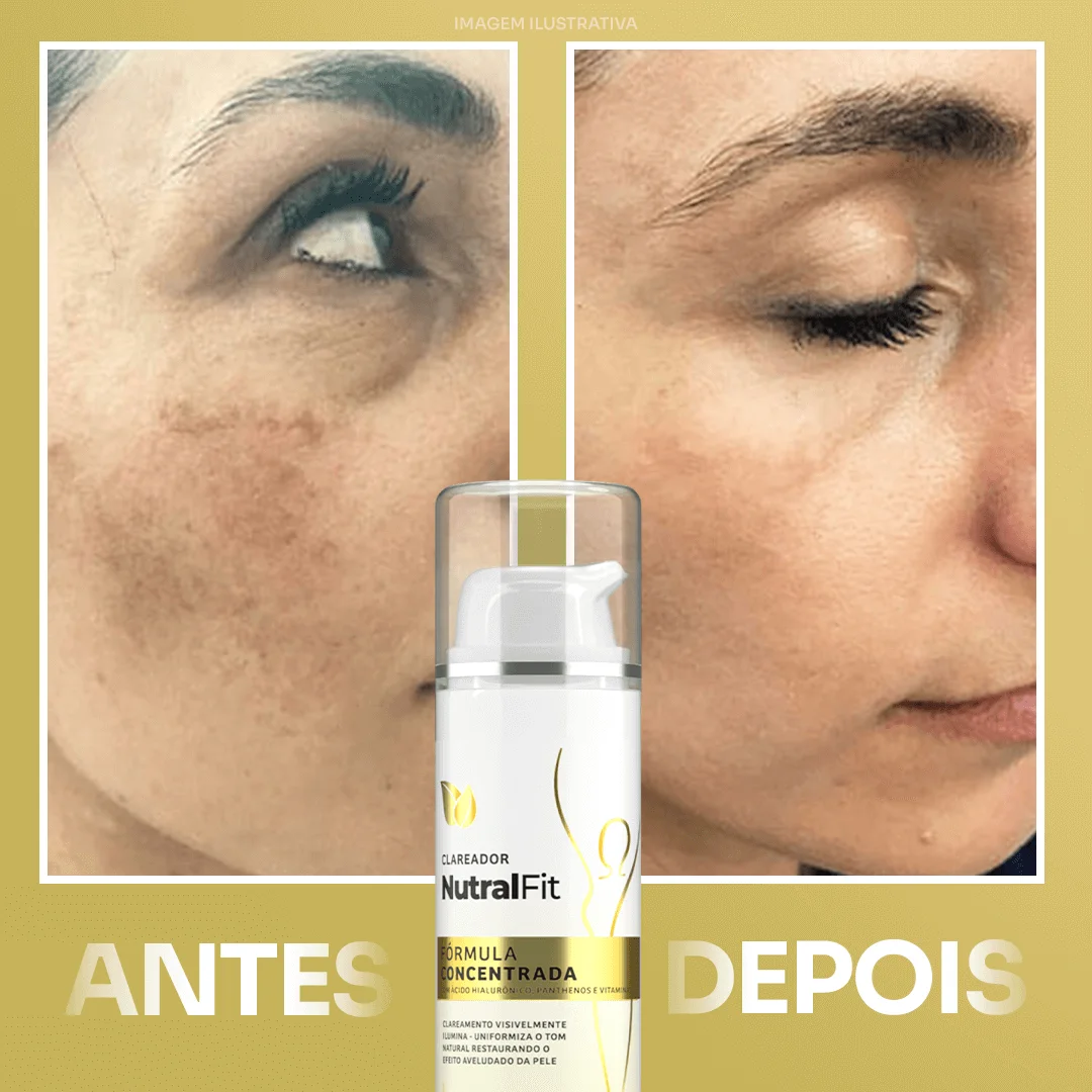 Clareador NutralFit - Imagem de antes e depois - percebesse uma grande diferença na pele