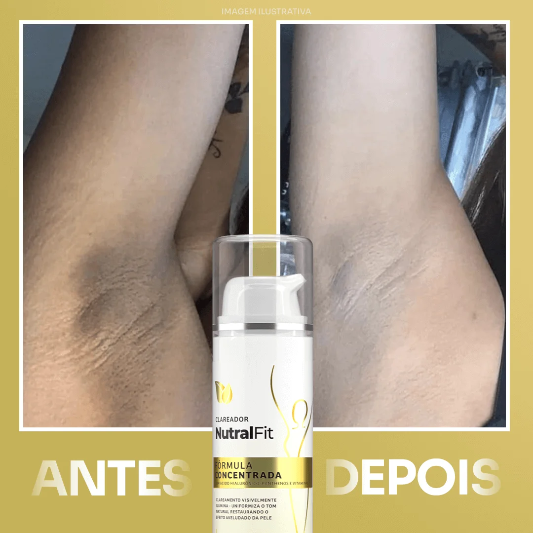 Clareador NutralFit - Imagem de antes e depois - percebesse uma grande diferença na pele
