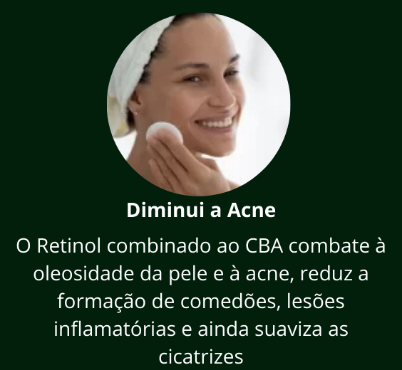 Renavidiol-beneficio - Diminui a Acne