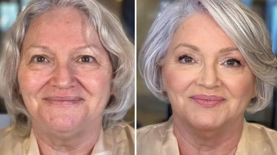 Imagem mostrando o antes e depois do uso do Renavidiol 